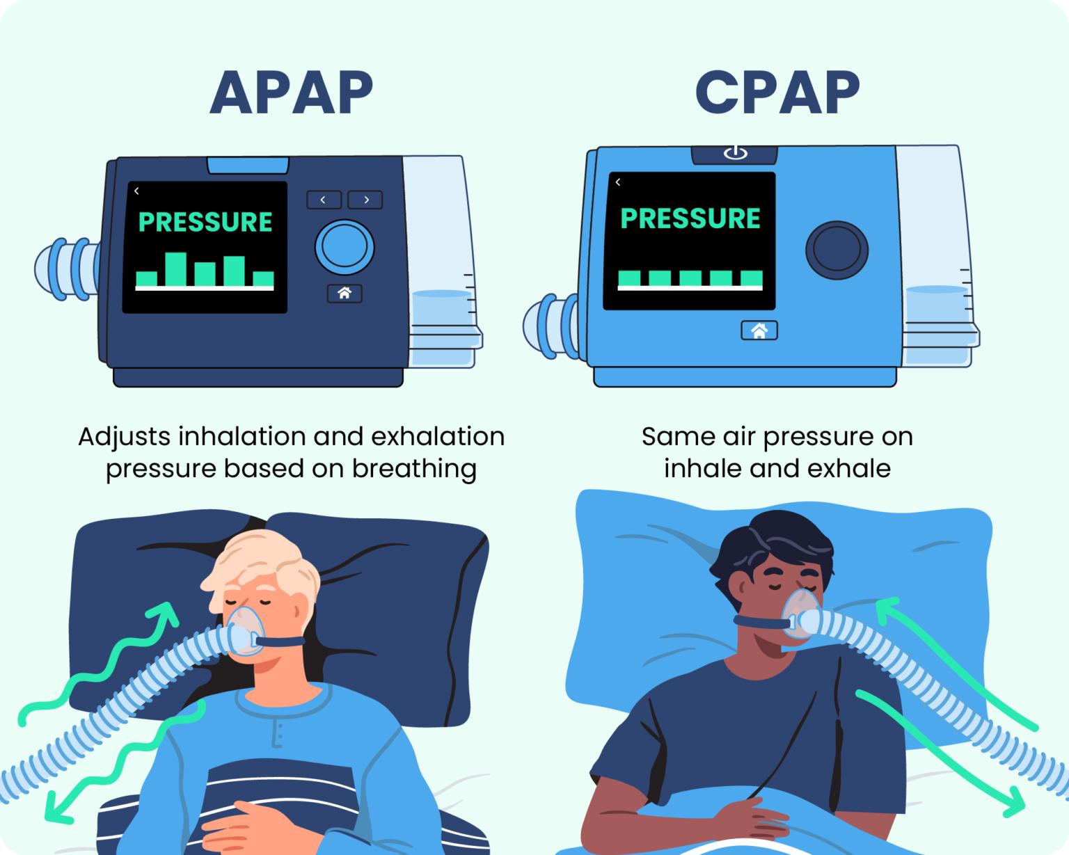 APAP phân tích các thay đổi của luồng khí và dấu hiệu liên quan đến tắc nghẽn để điều chỉnh áp lực trong phạm vi được thiết lập.
