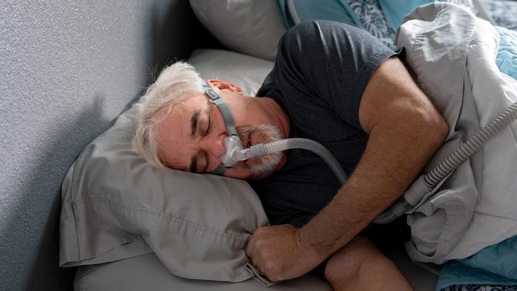 CPAP là một phương pháp hỗ trợ hô hấp được cân nhắc trong trường hợp COPD đồng thời có ngưng thở khi ngủ do tắc nghẽn, đặc biệt khi OSA là thành phần nổi bật của bệnh cảnh.